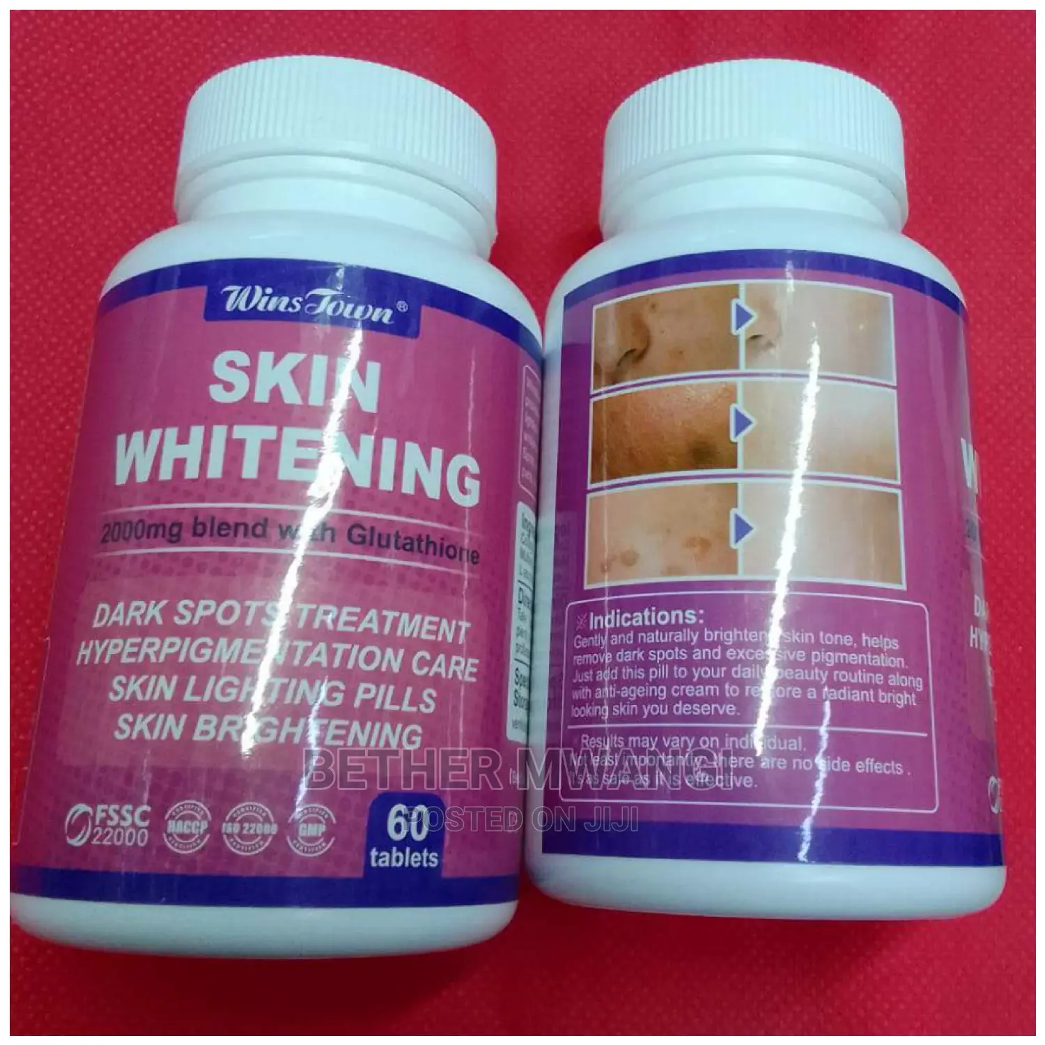 Skin Whitening Vitamins