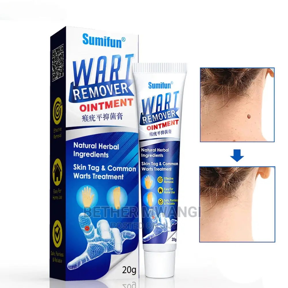 Original Wart Remover Ointment