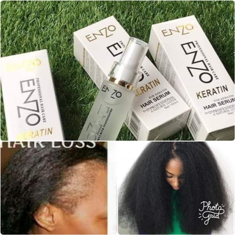 Enzo hair serum | Buy Online, Best Price, for sale in Kenya | Mybigorder  Best Shopping Ecommerce